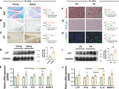 LTF induces senescence and degeneration in the meniscus via the NF-κB signaling pathway: A study based on integrated bioinformatics analysis and experimental validation